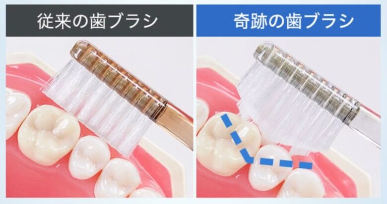 歯ブラシの形状