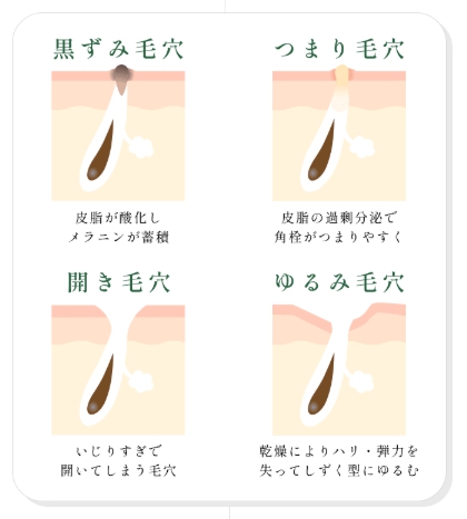毛穴