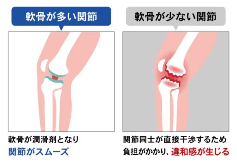 軟骨成分の状態