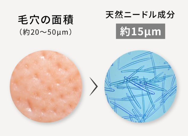 ニードル