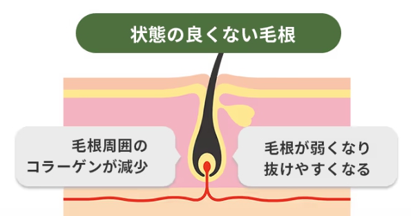 状態のよくない毛根